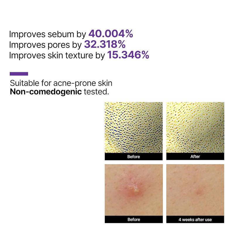 SOME BY MI Retinol Intense Reactivating Face Serum (30 ml)