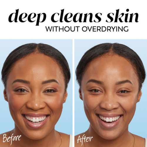 Olay Gentle Cleansing Melts