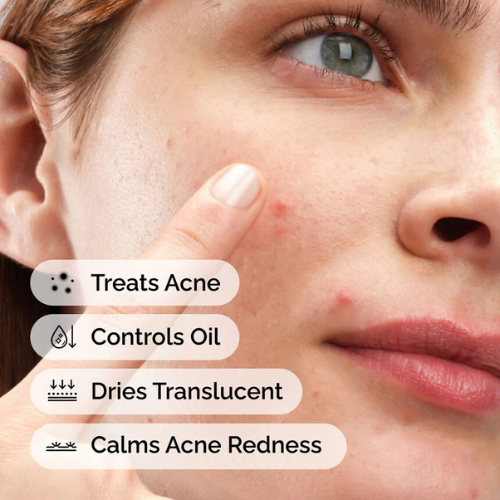 The Ordinary Sulfur 10% Powder-to-Cream Concentrate – Targeted Acne & Blemish Treatment