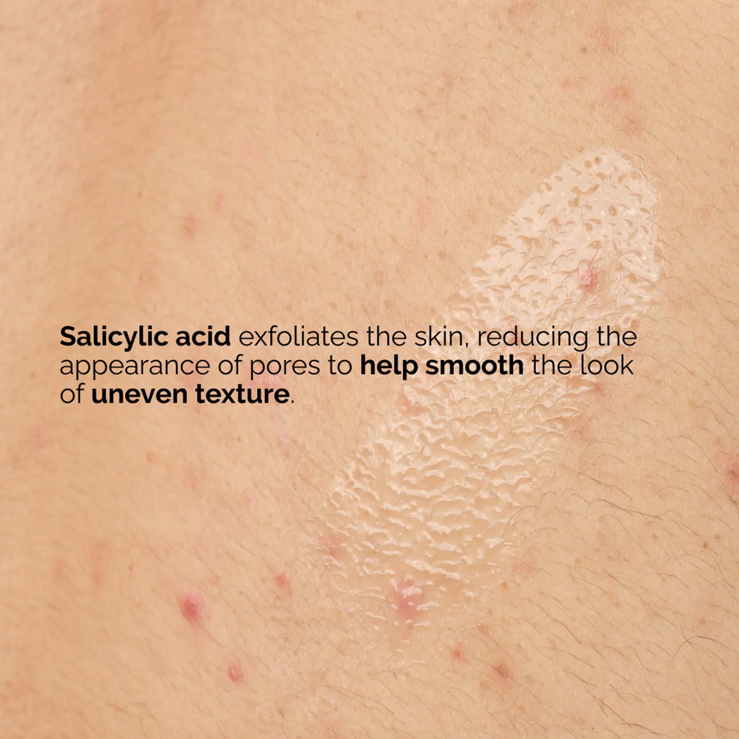 The Ordinary Salicylic Acid 0.5% Body Serum (240 ml)
