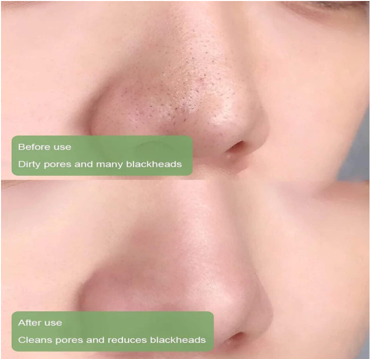 Green Tea Purifying Clay Mask Stick – Deep Cleanse & Oil Control for All Skin Types