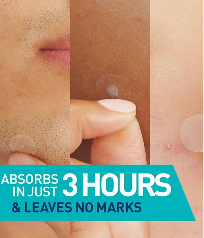 Blemish Barrier Patches – Fast-Acting Acne Healing & Protection
