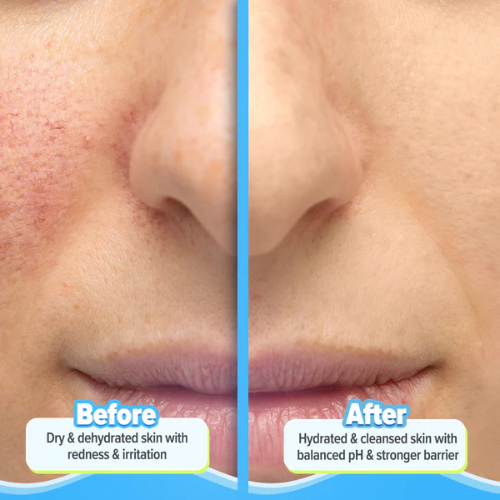 Aqualogical 5 Barrier+ Repair Gentle Cleanser with Avocado & 5 Essential Ceramides - 100 ml