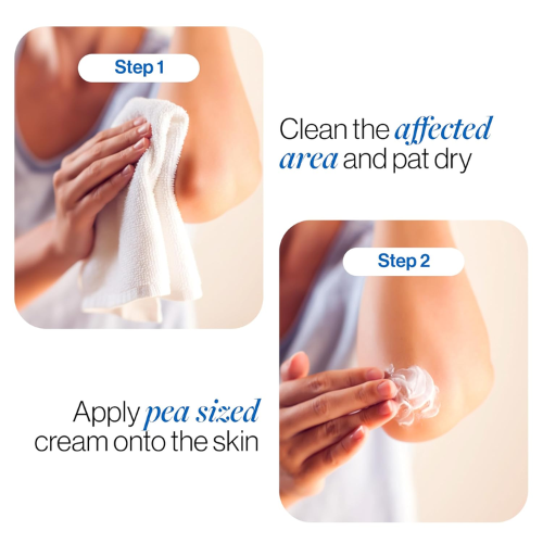 Be Bodywise Pigmentation Repair Cream for Dark Spots