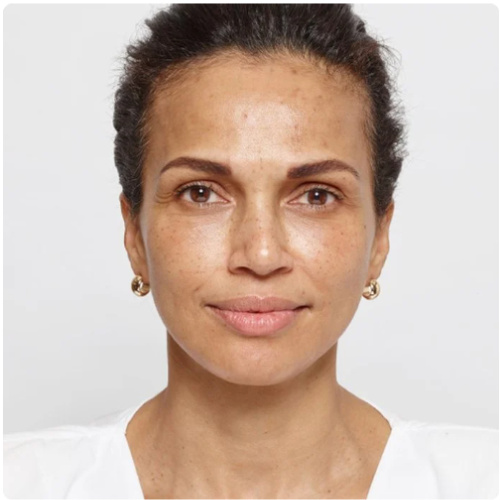Loreal Revitalift Plumping Day Cream – Hyaluronic Acid Moisturizer