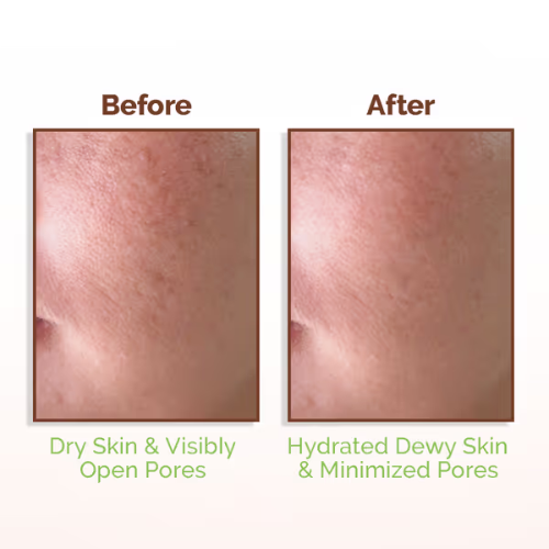 Mama Earth Rice Water Mama Earth Dewy Face Toner with 96% Pure Rice Water Extract & 4% Niacinamide for Glass Skin - 150 ml