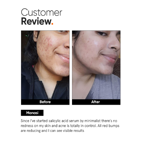 Minimalist Salicylic Acid 2% Face Serum 30ml