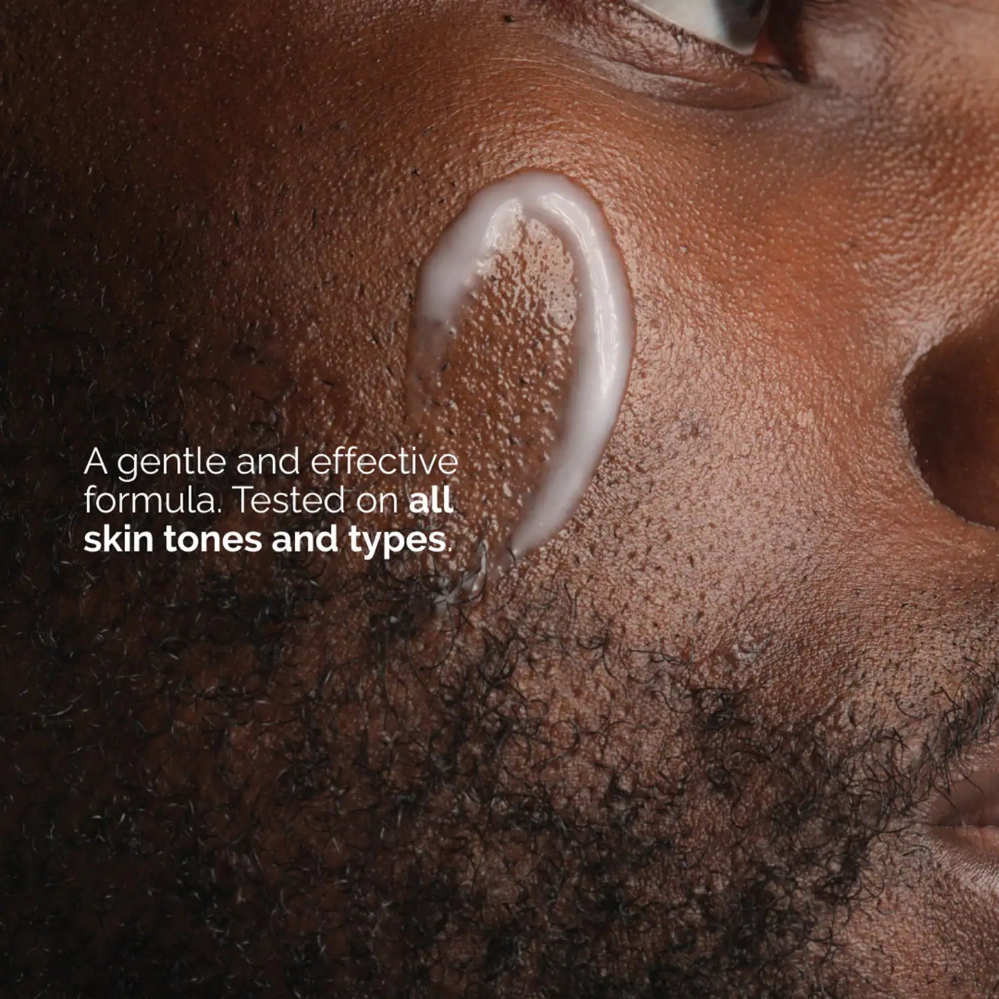 The Ordinary Niacinamide 5% Face & Body Emulsion (100 ml)