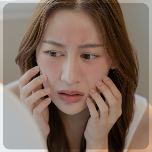 Sensitive Skin