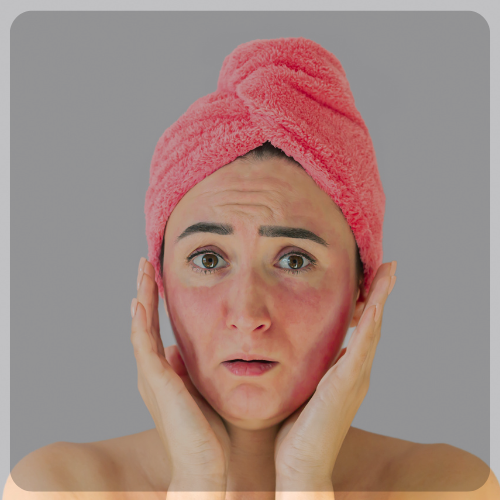 Irritation Skin