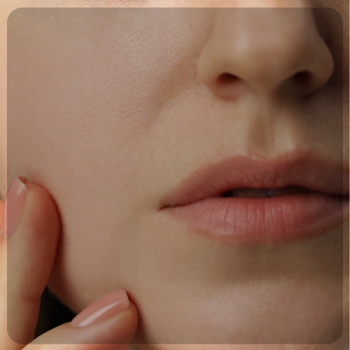 Dehydrated Skin