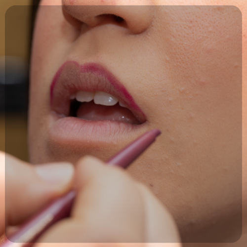 Lip Shape