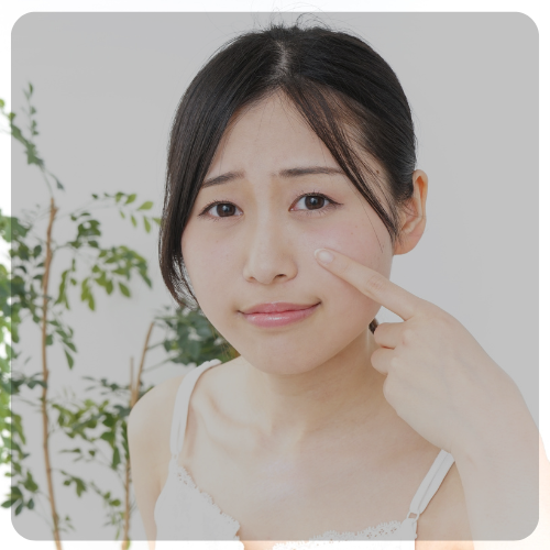 Skin Concern