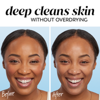 Olay Gentle Cleansing Melts