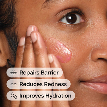 The Ordinary Soothing & Barrier Support Serum – Strengthens, Calms & Restores Skin Barrier | 30ml