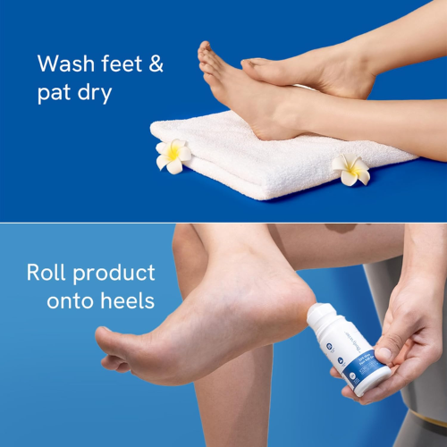 Be Bodywise 20% Urea Foot Roll On for Cracked Heels