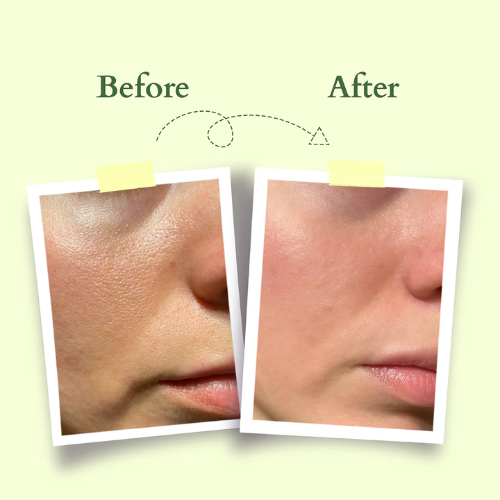 Lotus Divine Nutritive Crème SPF 20 | Daily Nourishing & Sun Protection Cream