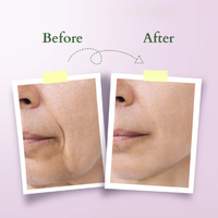 Lotus  Bakuchiol Plant Retinol Miracle Face Oil