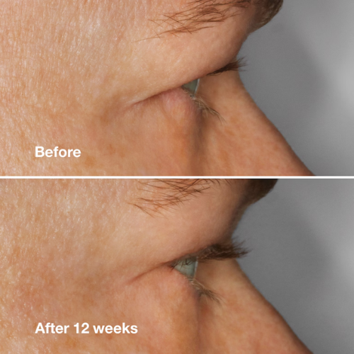 Clinique High Impact Lash Amplifying Serum 3ml