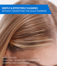 Gentle Hydrating Shampoo – Nourishing Care for Dry & Sensitive Scalp