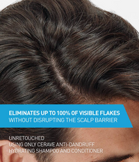Anti-Dandruff Hydrating Conditioner – Soothes Scalp & Restores Moisture Without Buildup