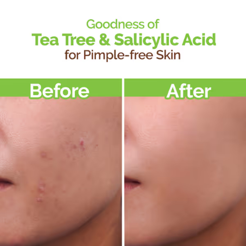 Mama Earth Tea Tree Pimple Control Face Wash with Tea Tree & Salicylic for Oily & Acne-Prone Skin