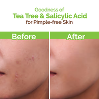 Mama Earth Tea Tree Pimple Control Face Wash with Tea Tree & Salicylic for Oily & Acne-Prone Skin