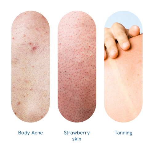 Be Bodywise 10% AHA Body Scrub for Smooth Skin