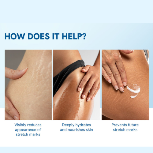 Be Bodywise Anti-Stretch Mark Serum Roll-On