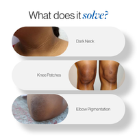 Be Bodywise Pigmentation Repair Cream for Dark Spots