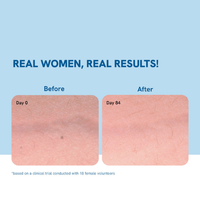 Be Bodywise Anti-Stretch Mark Serum Roll-On