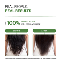Bare Anatomy Anti-Dandruff Hair Conditioner 175gm