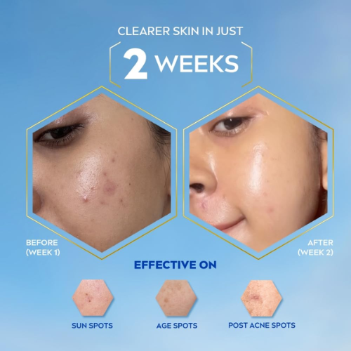 Nivea Luminous630 Oil Control Serum 40ml  | Clear Matte Skin