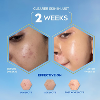 Nivea Luminous630 Oil Control Serum 40ml  | Clear Matte Skin