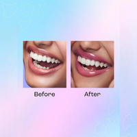 SUGAR Play Mega Hype Colour Changing Lip Oil
