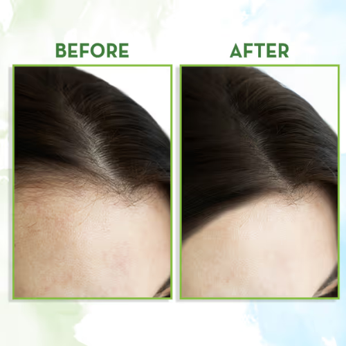 Mama Earth Rosemary Essential Oil for Hair Growth – 15ml