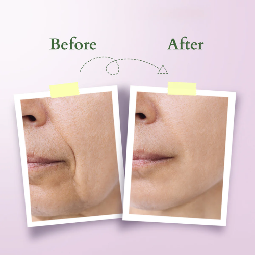 Lotus  Bakuchiol Plant Retinol Crème | Gentle Anti-Aging Care