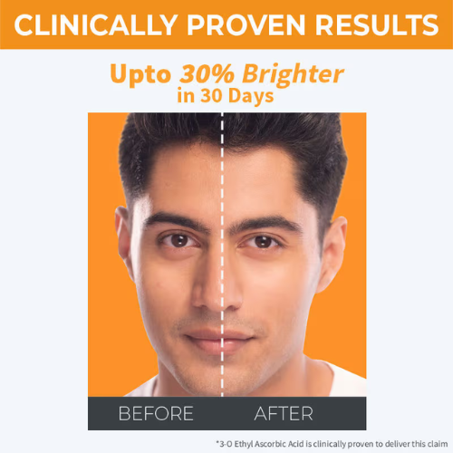 Nykaa SkinRX llluminate+ with 10% Vitamin C + 5% Niacinamide Serum for Bright, Radiant Skin Glow (30gm)