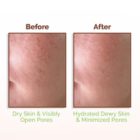 Mama Earth Rice Water Mama Earth Dewy Face Toner with 96% Pure Rice Water Extract & 4% Niacinamide for Glass Skin - 150 ml