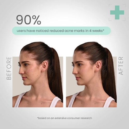 Lotus Kojic Acid + Berry Facewash | Blemish-Free Brightening