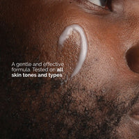 The Ordinary Niacinamide 5% Face & Body Emulsion (100 ml)